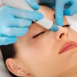 The Benefits of Hydrafacial® for Glowing Skin