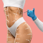 Body Contouring: What Is It, Benefits, Results